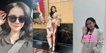 Mengaku Awalnya Karena Ikut-ikutan Teman, Alasan Sebenarnya Mawar AFI Lakukan Operasi Plastik Terungkap