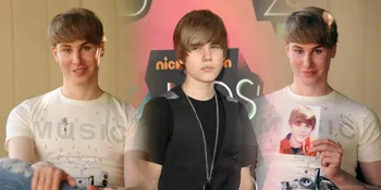 Penggila Operasi Plastik - Toby Sheldon Kembaran Justin Bieber
