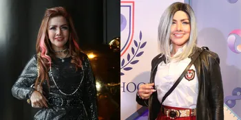 Potret Barbie Kumalasari yang Ditawari Rombak Bagian Tubuh oleh Klinik Luar Negeri, Minta Dibayar Satu Milliar Lebih