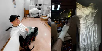 Potret Irwansyah Alami Patah Tulang Kaki, Kini Harus Digips - Tetap Bersyukur Karena Jadi Punya Waktu Untuk Anak
