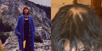 Potret Shareefa Daanish Sempat Alami Kebotakan Usai Idap Covid-19, Putuskan Potong Rambut Pendek - Kini Mulai Percaya Diri
