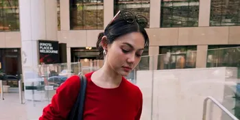 Rina Nose Curhat Bingung Adaptasi dengan Perubahan Wajahnya Pasca Oplas