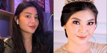 Sudah Lepas Hijab, Ini 8 Potret Rosa Meldianti Tampil Cantik Kenakan Mahkota - Percaya Diri Pamer Ketiak