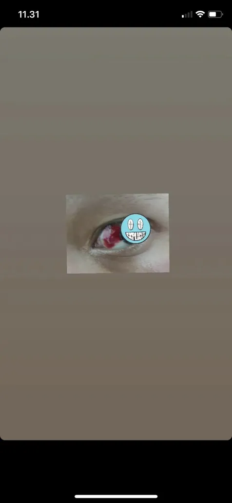 Mata Terkena Abu Rokok