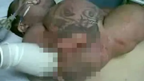 Ledakkan Lengan
