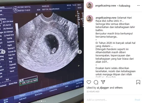 Minta Doa