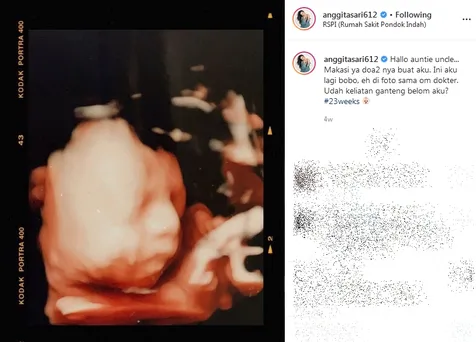 Ungkap Jenis Kelamin Anak