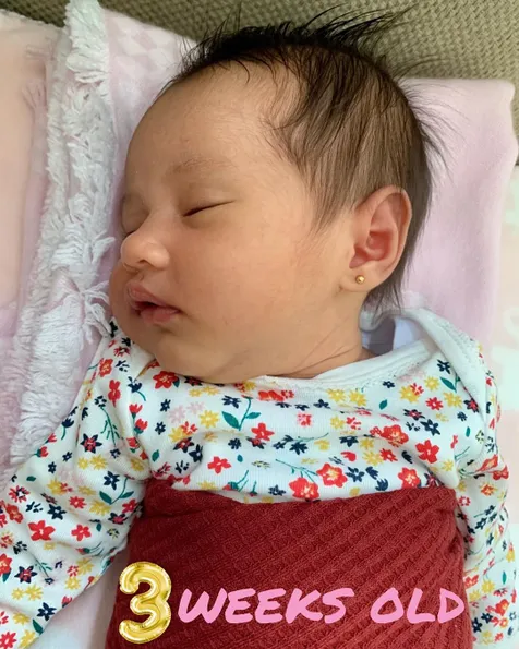 Sempat Idap Sakit Kuning
