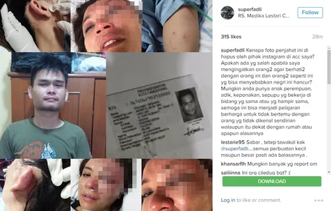 Fadli ceritakan kisah nahas sang adik lewat akun Instagram © Instagram/superfadli