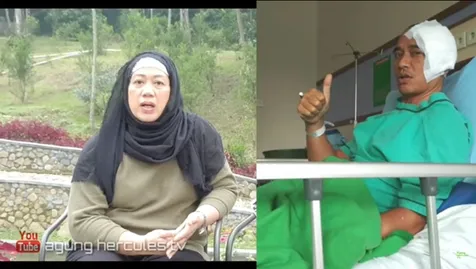 Agung Hercules Jalani 3 Kali Pengangkatan Tumor