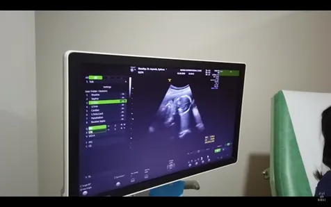 Syahnaz Ingin Anak Perempuan