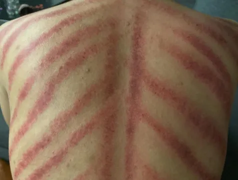 Ada Aurora Merah
