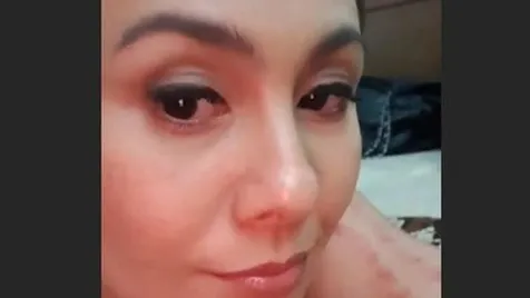 Lengan Wulan Guritno Memerah