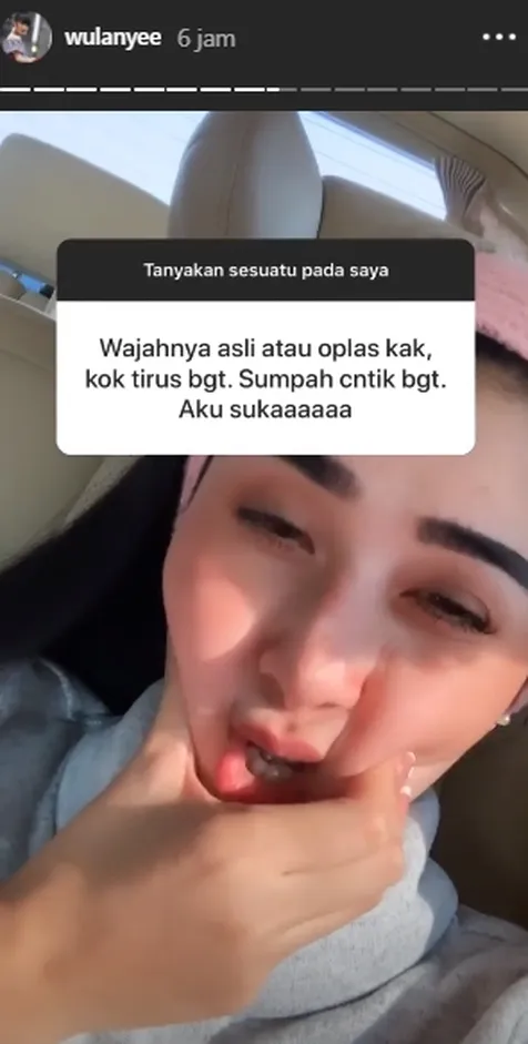 Asli Bukan Oplas