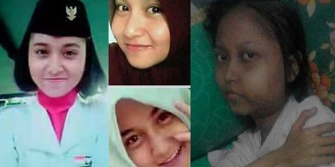 Setelah Cabut Gigi Geraham Gadis Manis Ini Malah Meninggal Dunia Kapanlagi Com