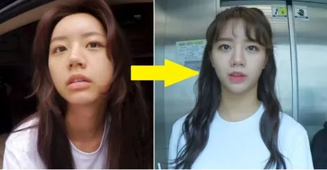 Before After