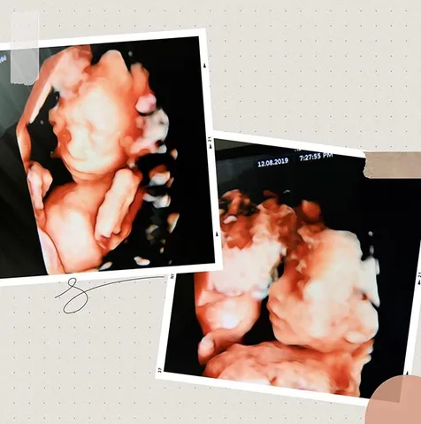 Nama Bayi Ammar Zoni & Irish Bella