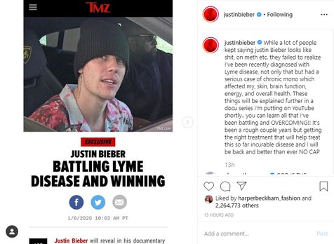 Dituduh Pakai Narkoba Justin Bieber Bantah Dan Mengaku Idap Lyme Disease Kapanlagi Com