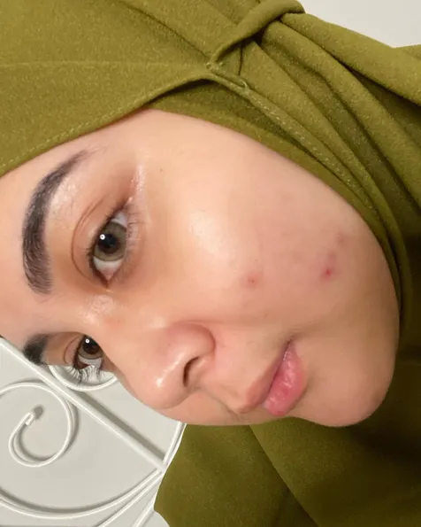 Lelah dengan Komentar Netizen