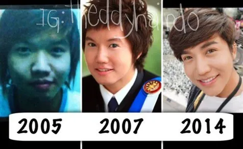 Fans Cewek 8 Tahun Jalani Oplas Demi Mirip Nichkhun