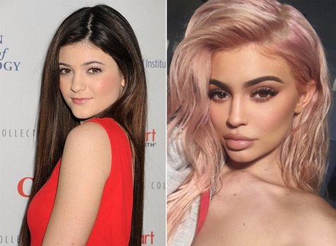 Kylie Jenner Dulu Dibully Kini Jadi Remaja Terkaya Di Hollywood Kapanlagi Com [ 348 x 476 Pixel ]