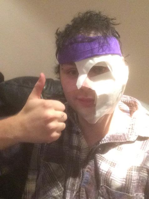 Michael Clifford dengan luka yang diterimanya @twitter.com - michael5sos