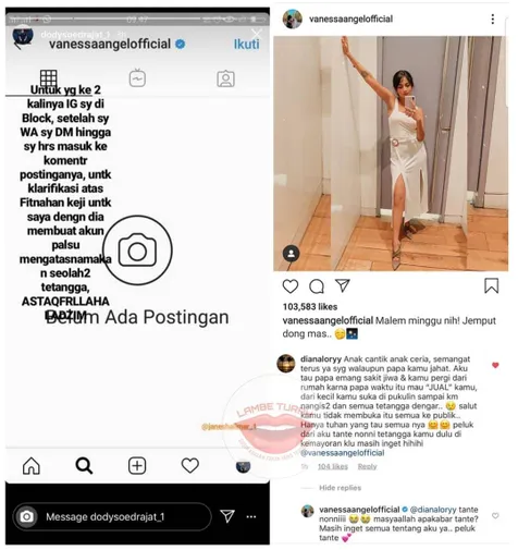 Beri Semangat Pada Vanessa Angel