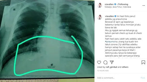 Tak Disarankan Jalani Tes Lanjutan