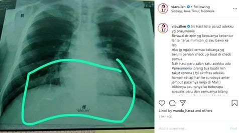 Setiap Hari Antar Jemput Pacar ke Mall