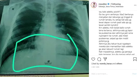 Awalnya Via Tak Tahu Adiknya Positif