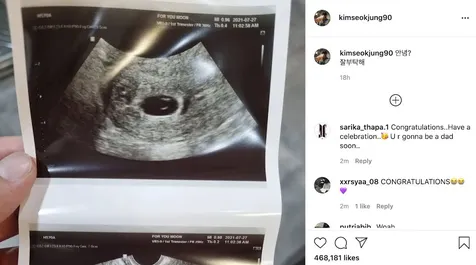 Fakta di Balik Jin BTS yang Siap Jadi Paman: Keponakan Pertama - Pilih 'Butter' Sebagai Nama Panggilan