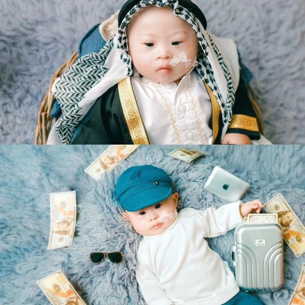 10 Photos of Nadya Shavira's Child with Down Syndrome, Adorable and Hoped to Be a Bridge to Heaven for Parents