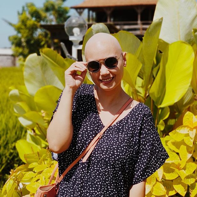 10 Photos of Feby Febiola Still Beautiful with a Bald Head After Battling Ovarian Cancer