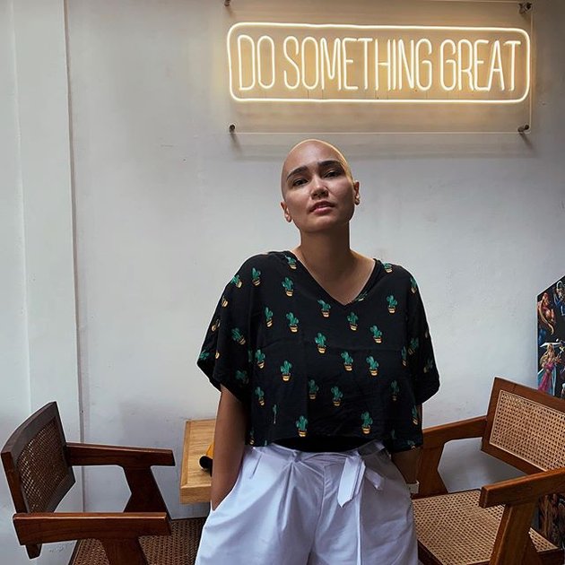 10 Photos of Feby Febiola Still Beautiful with a Bald Head After Battling Ovarian Cancer