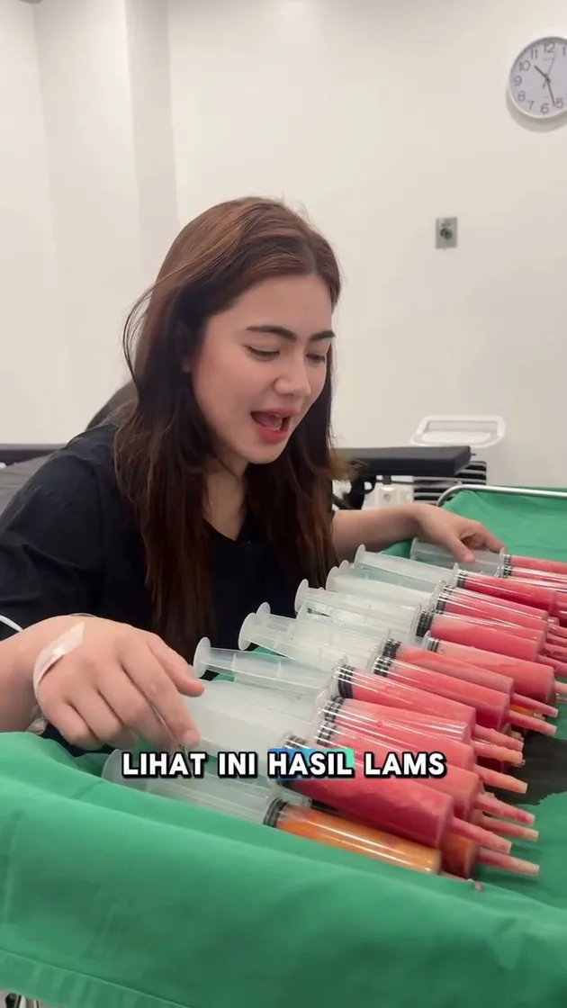 <nil>