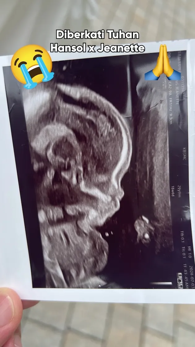 Istri Jang Hansol Hamil