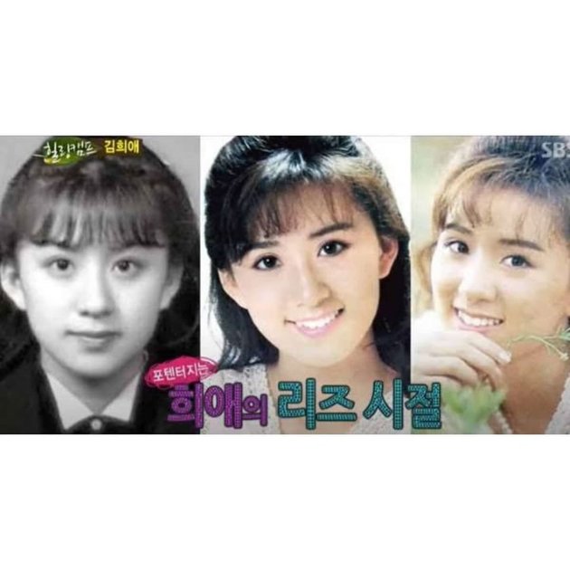 10 Potret Kim Hee Ae in her Youth, Dimpled Cheeks as a Distinctive Feature