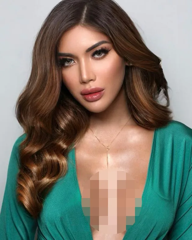 Transformasi Bibir Millendaru