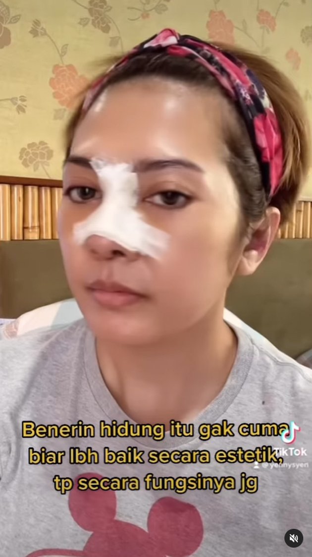 <nil>