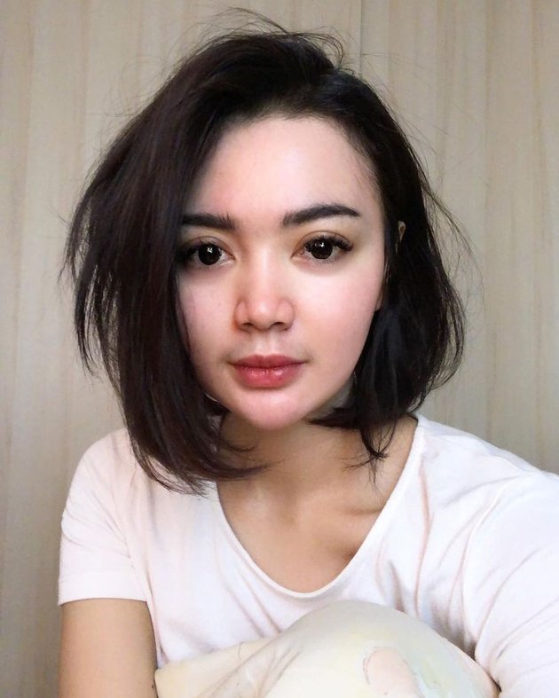 <nil>