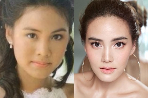 10 Beautiful and Popular Thai Celebrities Who Are Often Suspected of Plastic Surgery, Who Looks the Most Different?