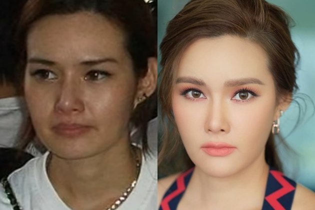 10 Beautiful and Popular Thai Celebrities Who Are Often Suspected of Plastic Surgery, Who Looks the Most Different?