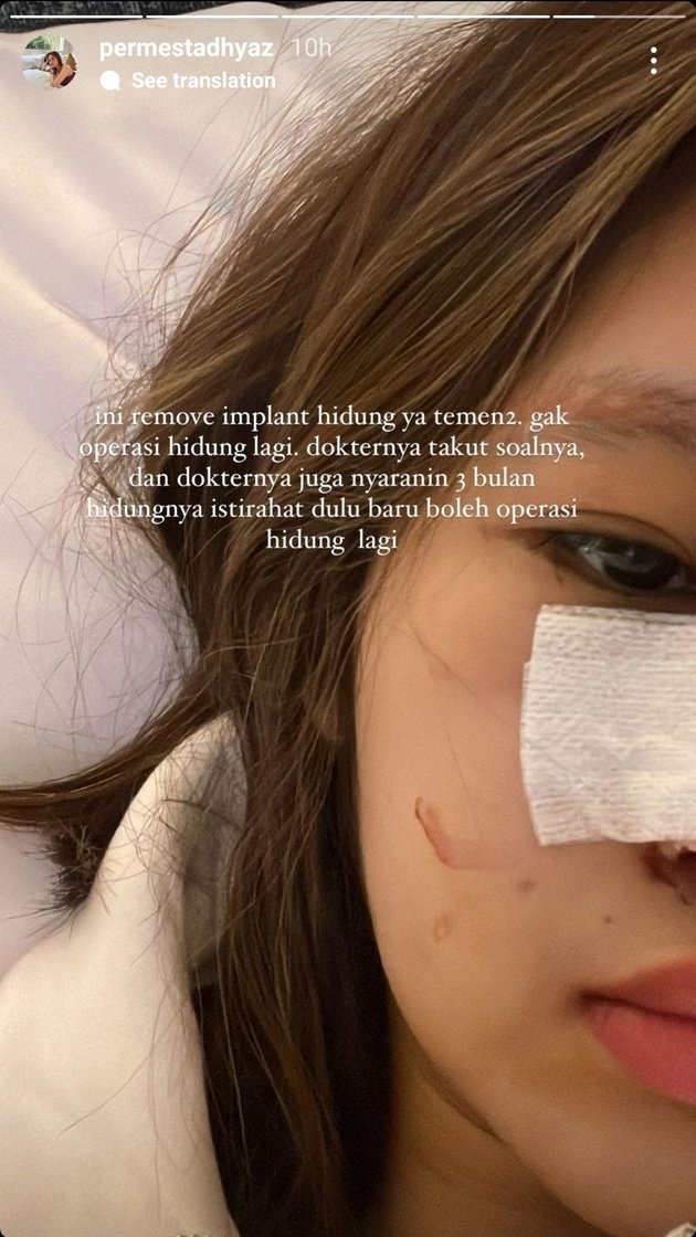<nil>