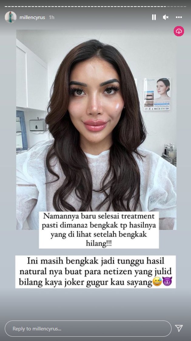 <nil>