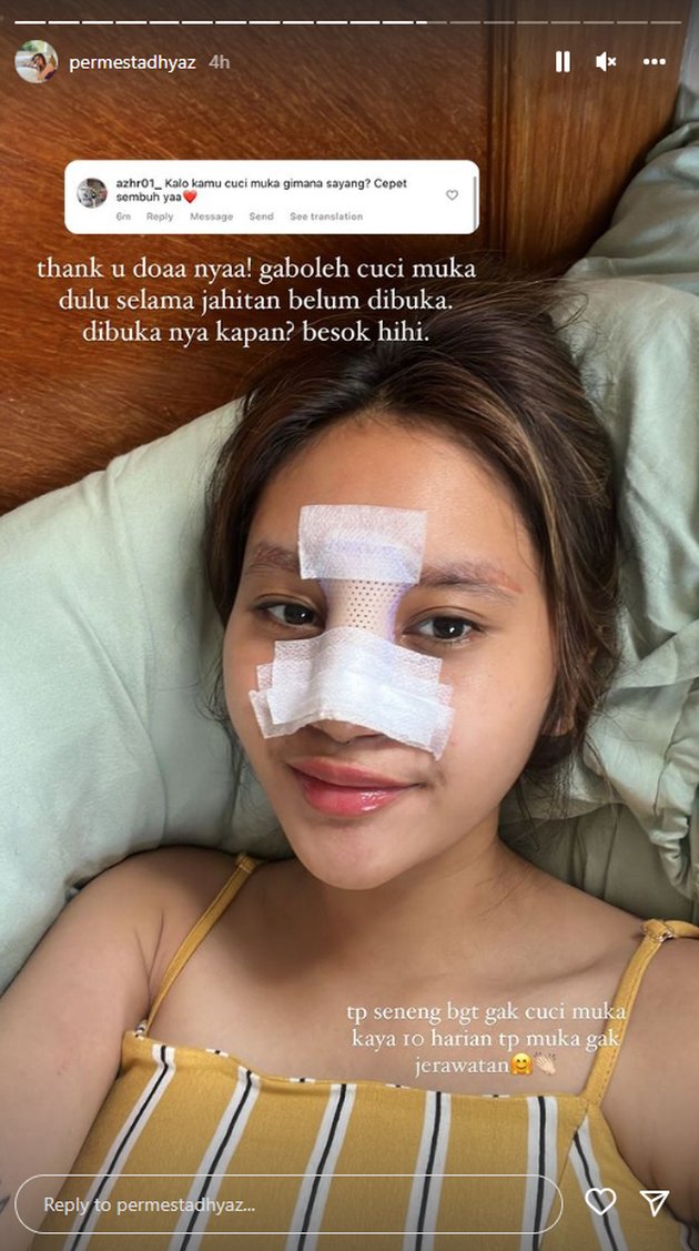 <nil>