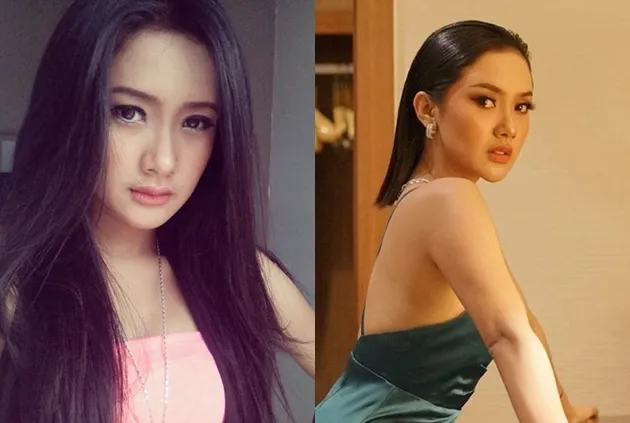 selebritis diduga oplas