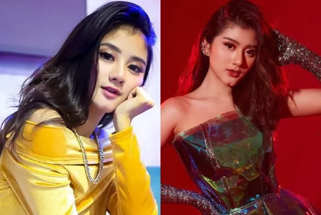 selebritis diduga oplas