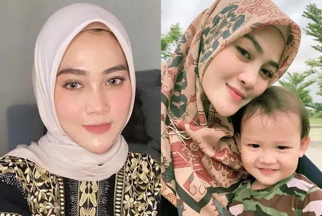 selebritis diduga oplas