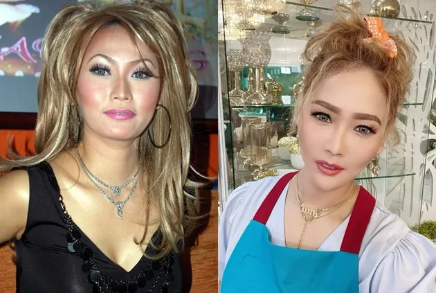 selebritis diduga oplas