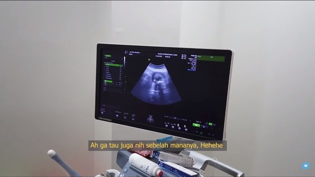 <nil>